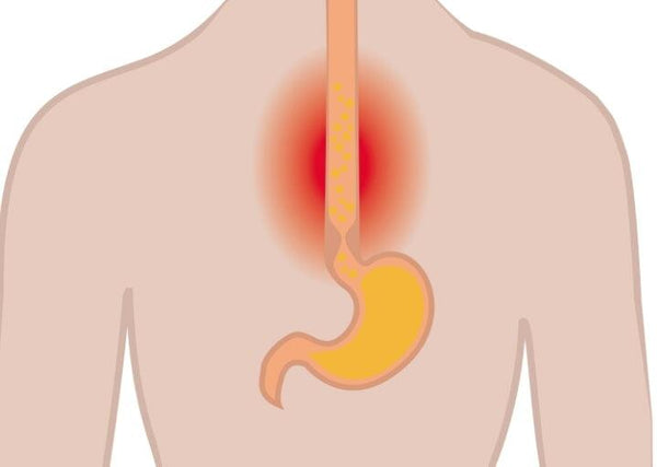 L’œsophagite à éosinophiles